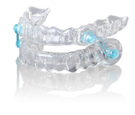 Oral mandibular advancement device used to treat mild to moderate sleep apnea